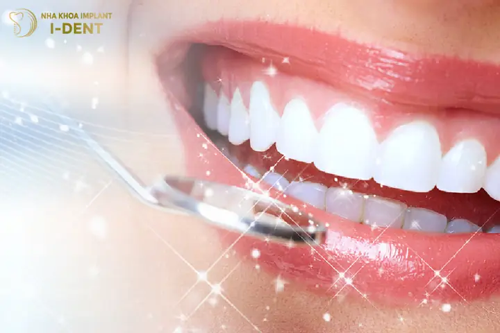 Ưu Điểm Ưu Điểm