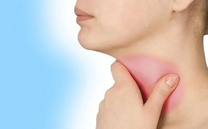 Xét Nghiệm Anti - Tg Giúp Theo Dõi Và Điều Trị Ung Thư Tuyến Giáp