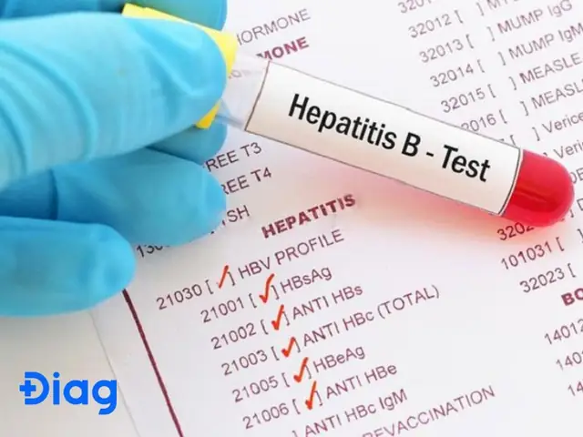 Cách Đọc Kết Quả Định Lượng Virus Viêm Gan B